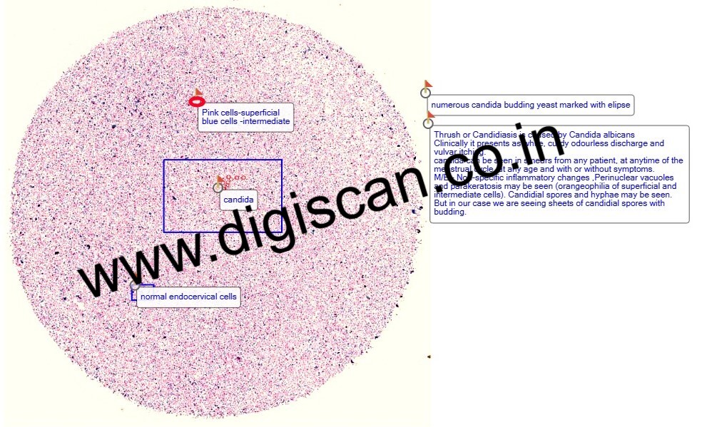 Cervical Cytology (Gynaecological Cytology) Digital Slides Set